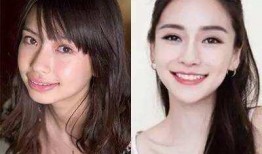 娱乐圈龅牙爆料,揭秘明星背后的秘密与争议